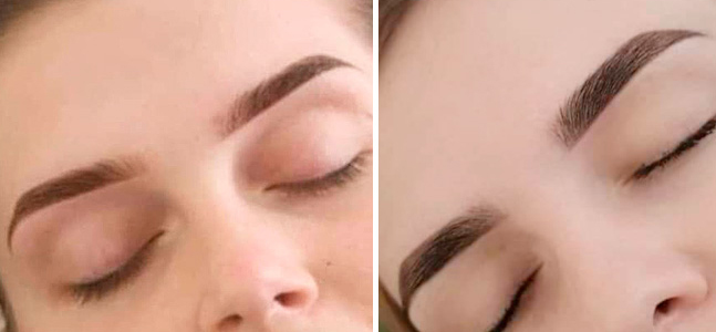 Протеиновая терапия «BTX» для бровей